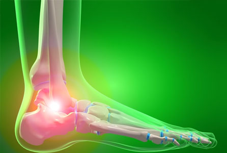 Ankle Pain