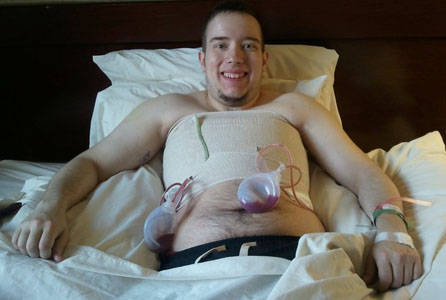 Chest Surgery Chest Surgery