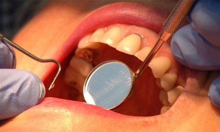 Oral Conditions Oral Conditions