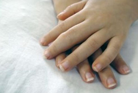 Rheumatological Conditions Rheumatological Conditions